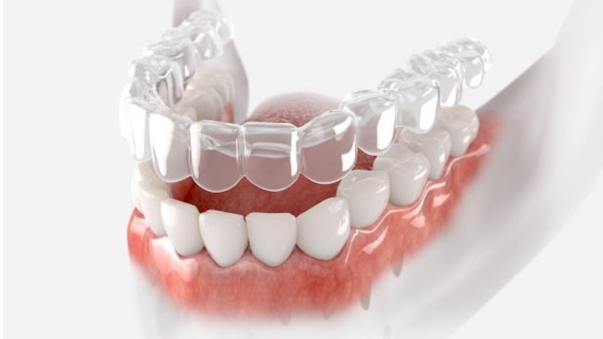 Best Dental Clinic in Pimple Saudagar