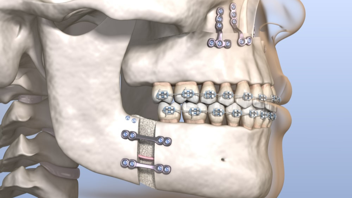 Best Dental Clinic in Pimple Saudagar for maxillofacial surgery
