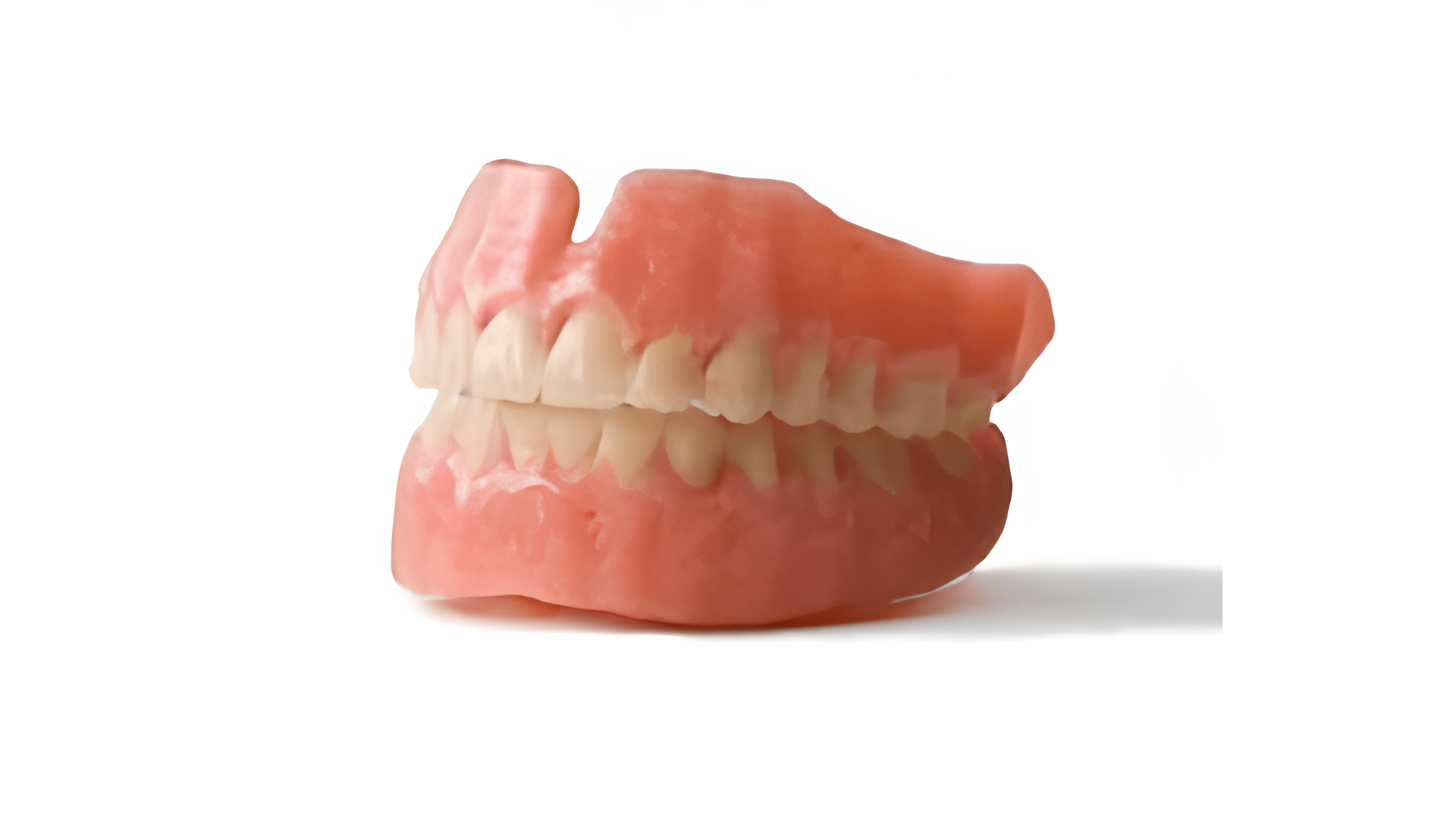 Best Dental Clinic in Pimple Saudagar for prosthodontics